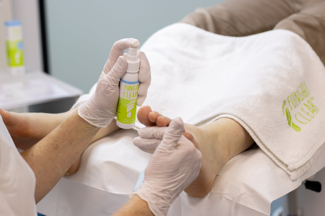 Who Is at Risk for Toenail Fungus? Understanding Risk Factors and Prevention
